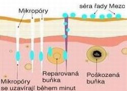 Peercing